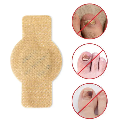 #1 Fungal Nail Patches