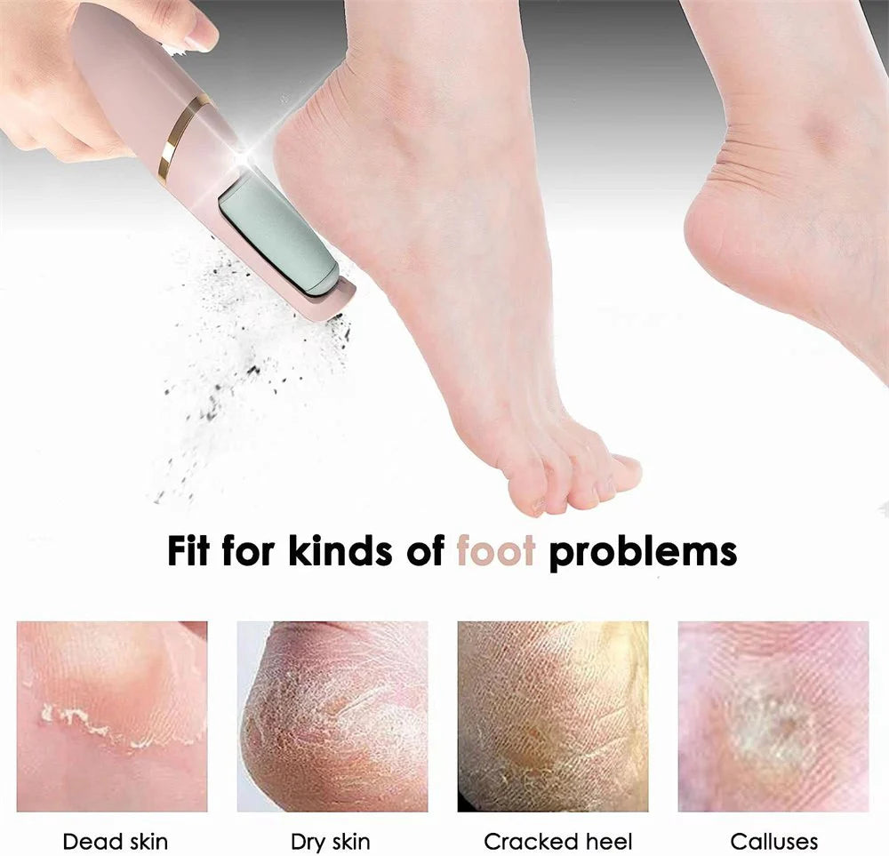 Foot Callus Remover